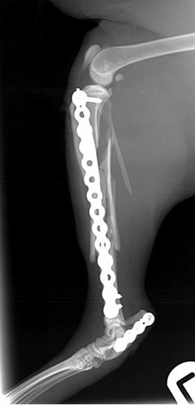 Immediate post-operative radiographs